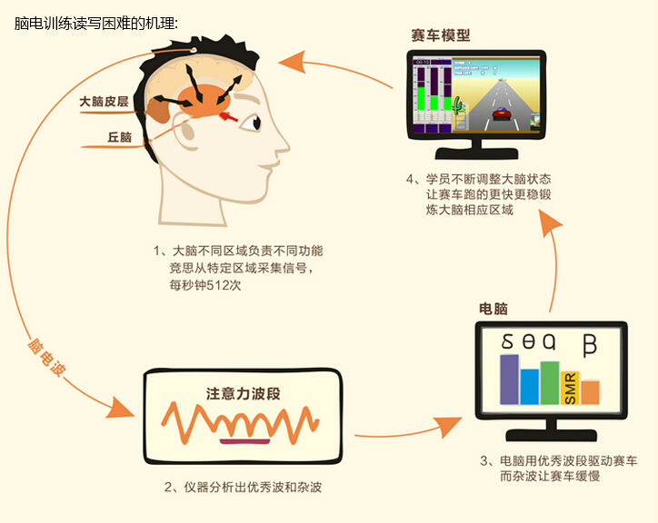 腦電生物訓練