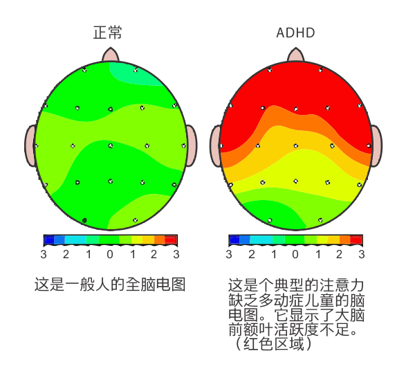 多動癥.gif